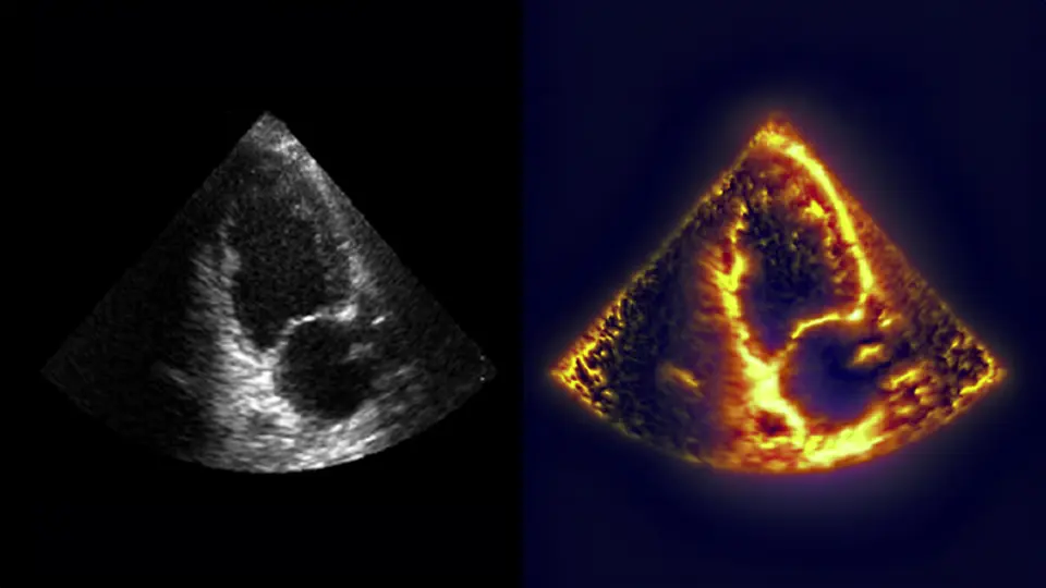 liver-scan-pons-71322.jpg liver-scan-pons-71322.jpg
